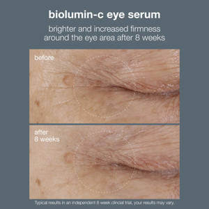 Dermalogica Biolumin C Eye Serum 15ml